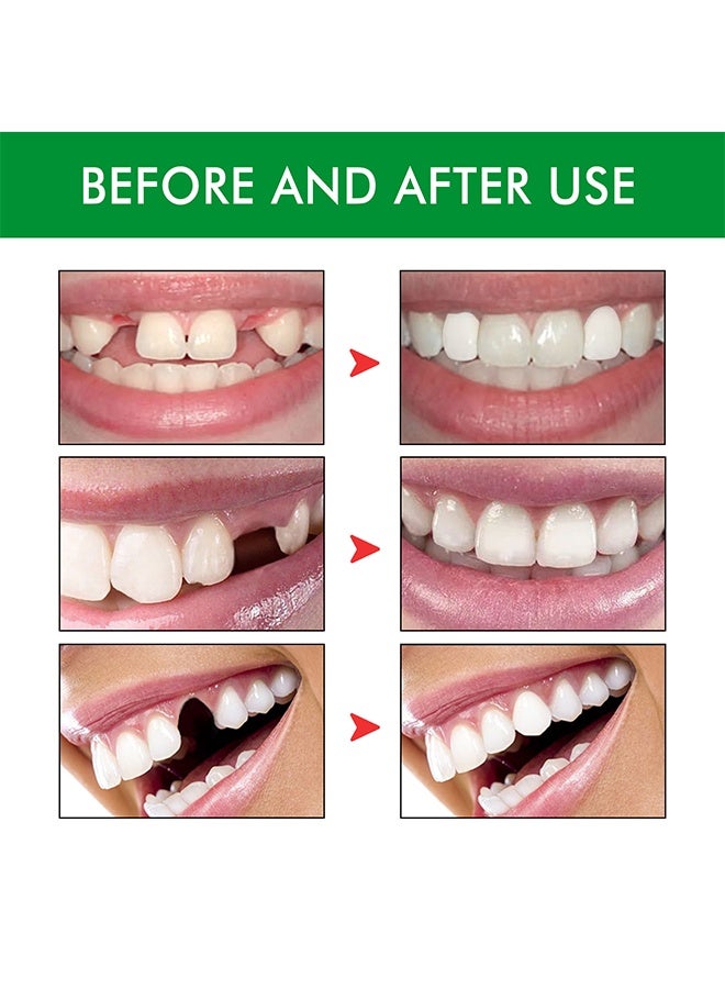 EELHOE Short Term Tooth Kit 30g+30g, Temporary Denture Replacement Bead Set with 3 Pieces Dental Tweezers Tools, for Temporary Repair of Missing and Broken Teeth Replacement Dentures - Image 4